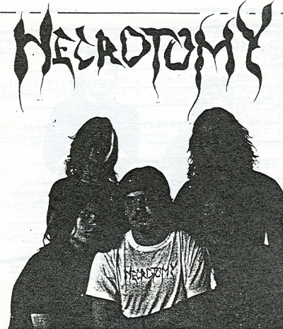 Necrotomy